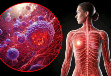 Covid and flu viruses can wake up breast cancer cells spread in lungs: Study