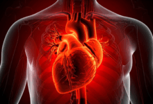 Covid can accelerate ageing in blood vessels by 5 years in women: Study