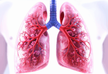 Antibody drug shows promise against lung cancer in first human trial