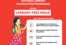Free diagnosis, treatment ensuring a leprosy-free India: Govt