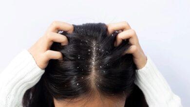 The ‘dark’ fact behind dandruff shampoos.