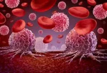 క్యాన్సర్ ఎలా నివారించాలి ఆరోగ్య సూచనలు