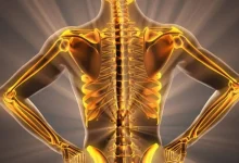 Are Weak Bones a Threat to Life?