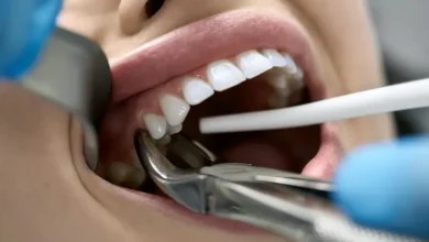 Fears About Tooth Extraction..! What Do Doctors Say?